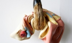 ANIMAL FALLS IN THE FOREST DOES IT MAKE A SOUND_______ melted plastic, deer foot 23X 29X 15,5 cm / 2011